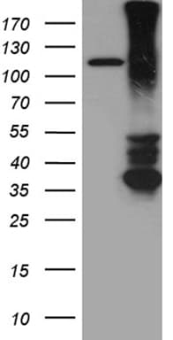 Monoclonal Mouse anti-Human RGMA Antibody (clone OTI1C5, aa169-424, WB)