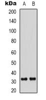 CCND3 / Cyclin D3 Antibody (C-Terminus)