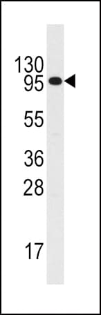 CSF2RB / CD131 Antibody (aa744-773)