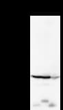 YARS / Tyrosyl-tRNA Synthetase Antibody (clone YAR5H08)