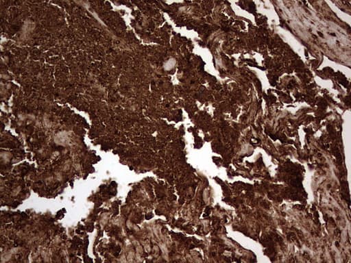 Monoclonal Mouse anti-Human CEACAM5 / CD66e Antibody (clone OTI3D8, aa35-680, IHC, WB)
