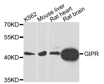 Polyclonal Rabbit anti-Human GIPR / GIP Receptor Antibody (WB)