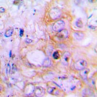 Polyclonal Rabbit anti-Human BMP2 Antibody (Internal, IHC, WB)