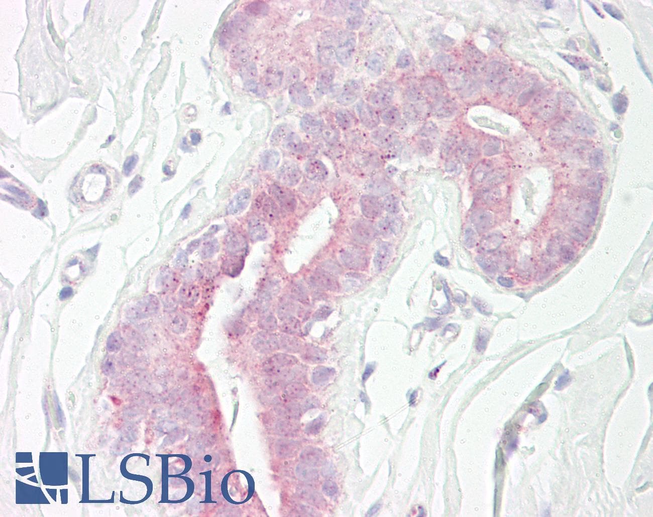 IHC-plus™ RPS6KB1 / P70S6K / S6K Antibody (aa261-310)