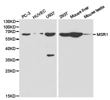 MSR1 / CD204 Antibody