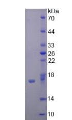 Human EMA / MUC1 Protein (Recombinant His, N-Terminal)