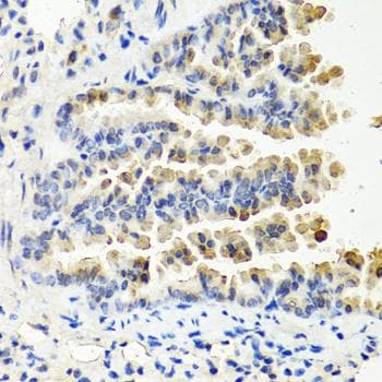 NTF3 / Neurotrophin 3 Antibody
