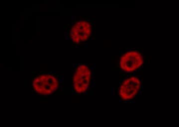 STAT5A Antibody (phospho-Tyr694)