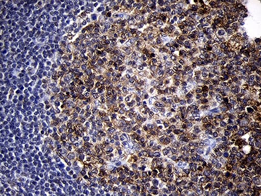 MME / CD10 Antibody (aa411-750, clone OTI2A3)