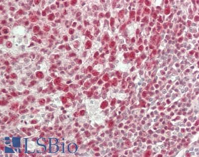 IHC-plus™ SFRS7 / 9G8 Antibody (aa75-125)