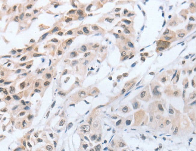 Polyclonal Rabbit anti-Human CHRNA10 Antibody (IHC)