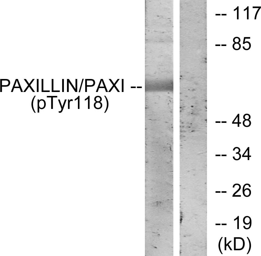 PXN / Paxillin Antibody (phospho-Tyr118)