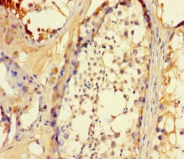 SLC25A14 / UCP5 Antibody