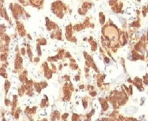 KRT18 / CK18 / Cytokeratin 18 Antibody (clone KRT18 Cocktail)