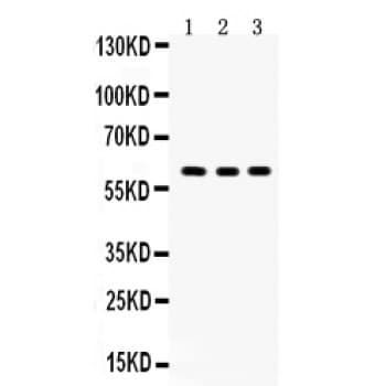 YES1 / c-Yes Antibody (aa7-35)