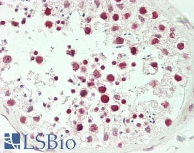 IHC-plus™ TP53 / p53 Antibody (phospho-Ser20)
