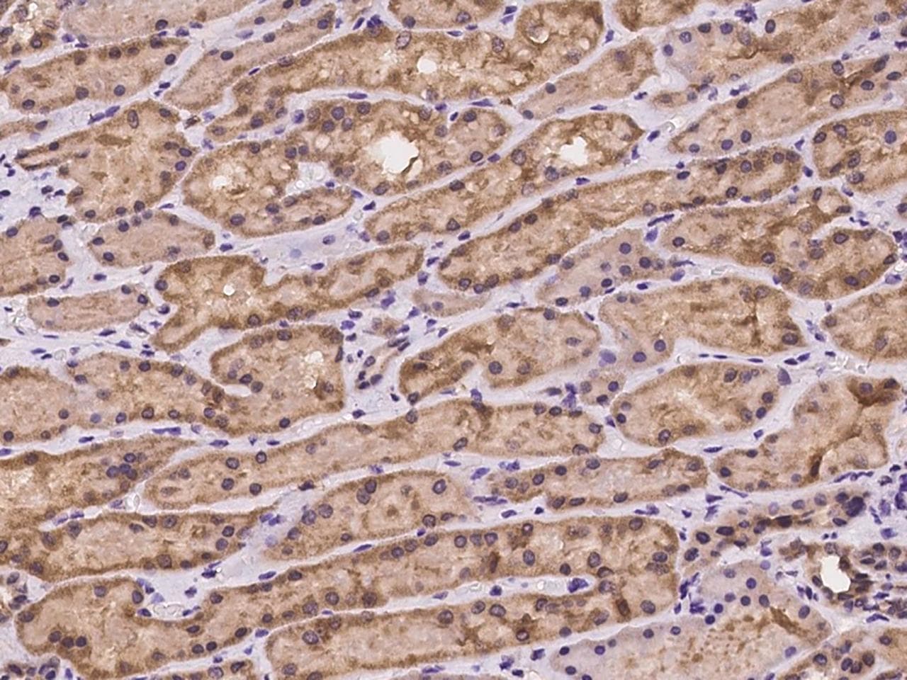 STAU1 / Staufen Antibody