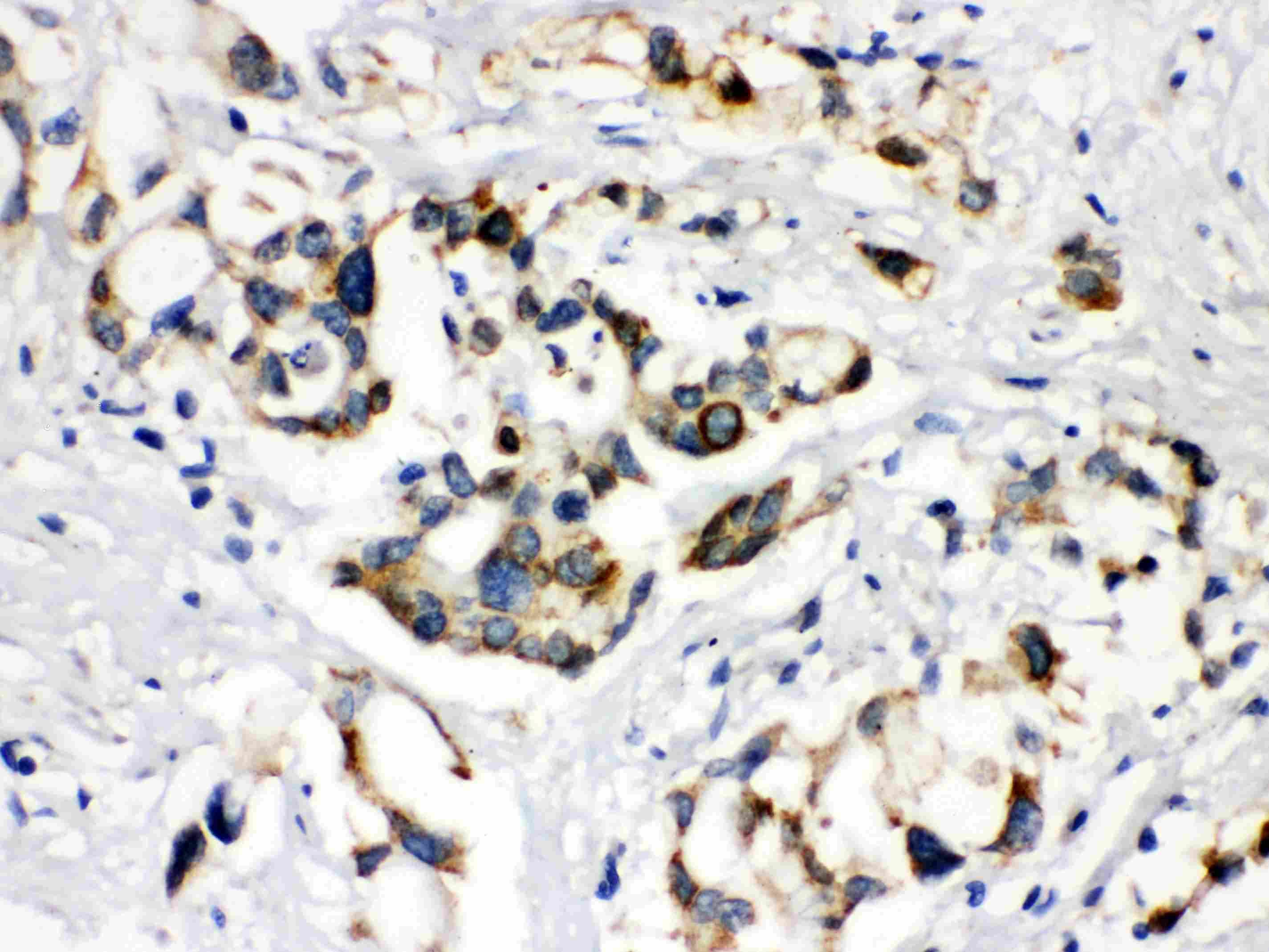 ABCB11 / BSEP Antibody