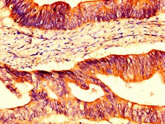 Polyclonal Rabbit anti-Human OCLN / Occludin Antibody (IHC, IF, WB)