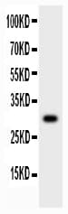 Polyclonal Rabbit anti-Human MMP7 / Matrilysin Antibody (aa1-267, IHC, WB)