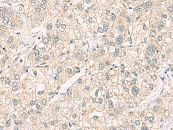 Polyclonal Rabbit anti-Human C3orf38 Antibody (IHC)