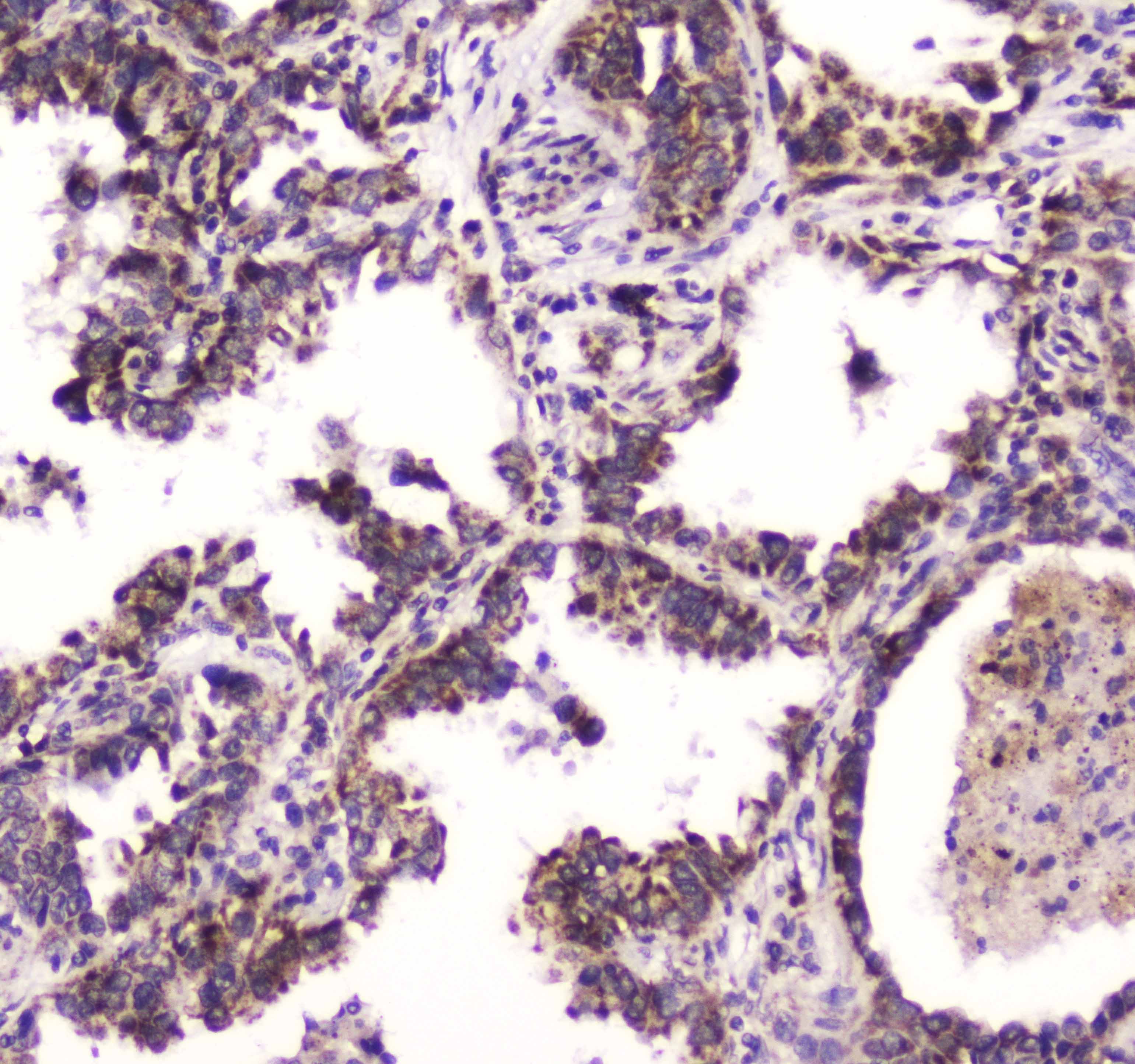 BRD7 Antibody