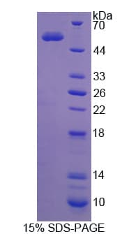 Human GLTP Protein (Recombinant His-GST)
