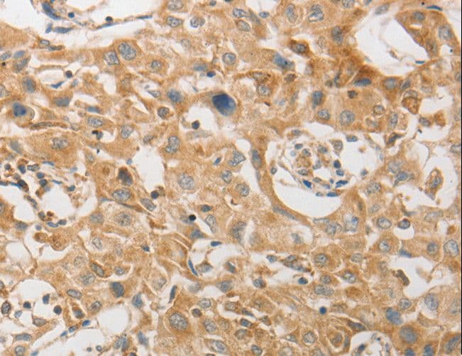 Polyclonal Rabbit anti-Human PAP2a / PPAP2A Antibody (IHC)