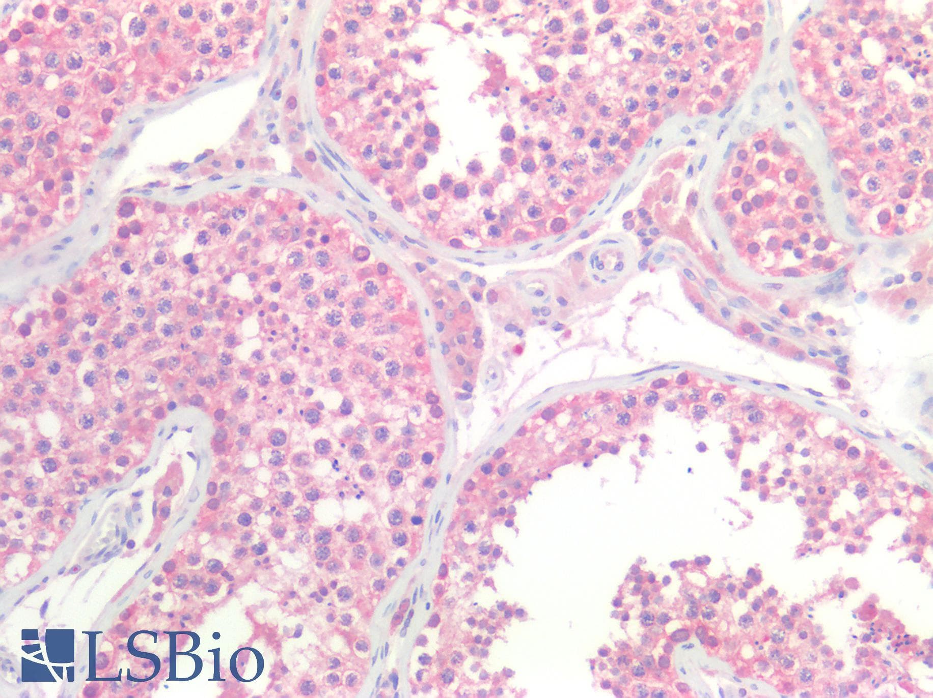 Monoclonal Mouse anti-Human RHOC Antibody (IHC, WB)