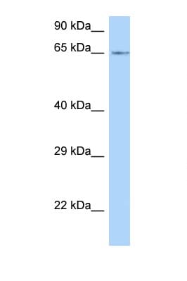 LMOD1 Antibody (C-Terminus)