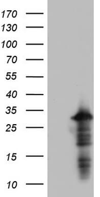 PRX-1 / PRRX1 Antibody (clone OTI4E11)