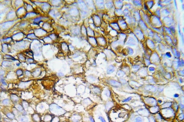 FGFR1 / FGF Receptor 1 Antibody (phospho-Tyr154)
