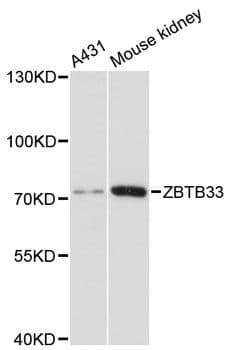 Polyclonal Rabbit anti-Human ZBTB33 / Kaiso Antibody (WB)