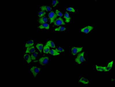 Polyclonal Rabbit anti-Human MCC Antibody (IHC, IF)