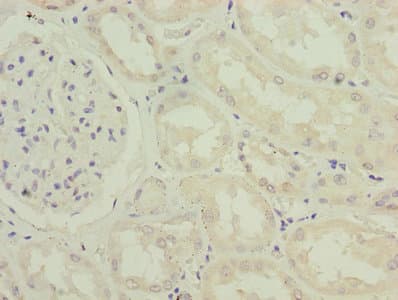 Polyclonal Rabbit anti-Human IFI44 Antibody (IHC, WB)
