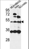 ISLR Antibody (aa333-362)