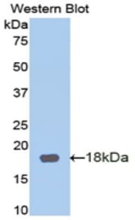 POSTN / Periostin Antibody (aa97-230)