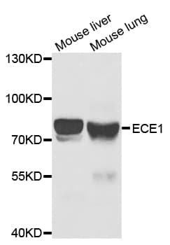 Polyclonal Rabbit anti-Human ECE-1 Antibody (IHC, WB)