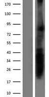 RPRML Protein (Over-Expression Lysate Myc-DDK (Flag))