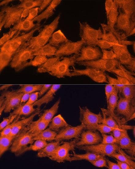 PRKCB / PKC-Beta Antibody