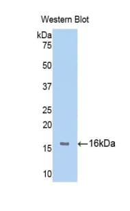 FGFR1 / FGF Receptor 1 Antibody (aa236-362)