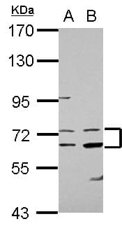 IHC-plus™ Polyclonal Rabbit anti-Human COL4A3BP / CERT Antibody (N-Terminus, IHC, WB)