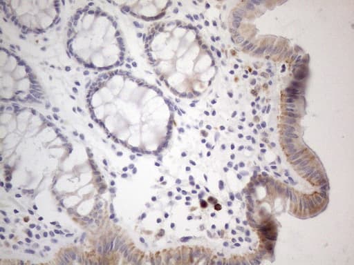 Monoclonal Mouse anti-Human APOBR / APOB48R Antibody (clone OTI6D3, aa780-1088, IHC)