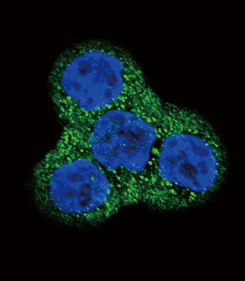 PDGFRB / PDGFR Beta Antibody (aa40-72)