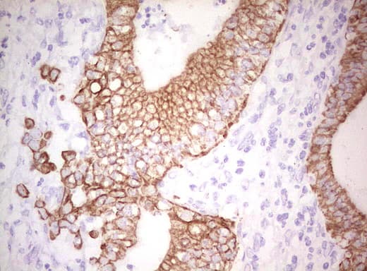Monoclonal Mouse anti-Human Basic Cytokeratin AE3 Antibody (clone AE3, Carrier-free, IHC)