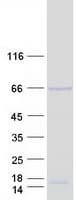 Human ACD / PTOP Protein (Recombinant Myc-DDK (Flag))
