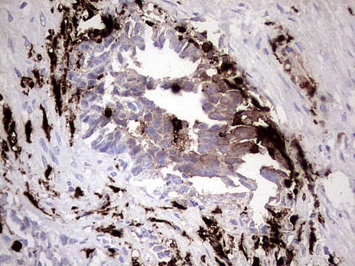 S100A9 / MRP14 Antibody (clone UMAB173)