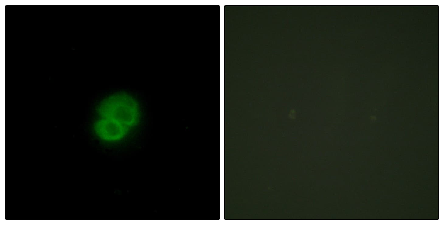Polyclonal Rabbit anti-Human ARMCX2 Antibody (aa321-370, IF, WB)