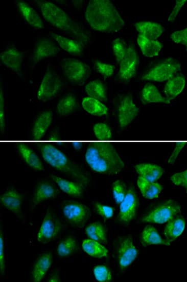 Polyclonal Rabbit anti-Human KIR2DL3 / CD152B2 Antibody (IHC, IF, WB)
