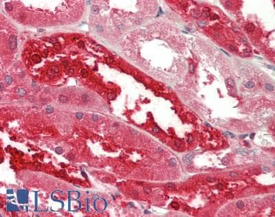 IHC-plus™ CA2 / Carbonic Anhydrase II Antibody